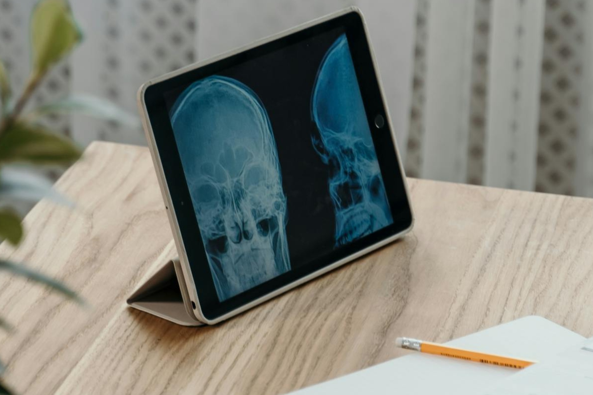brain injury compensation